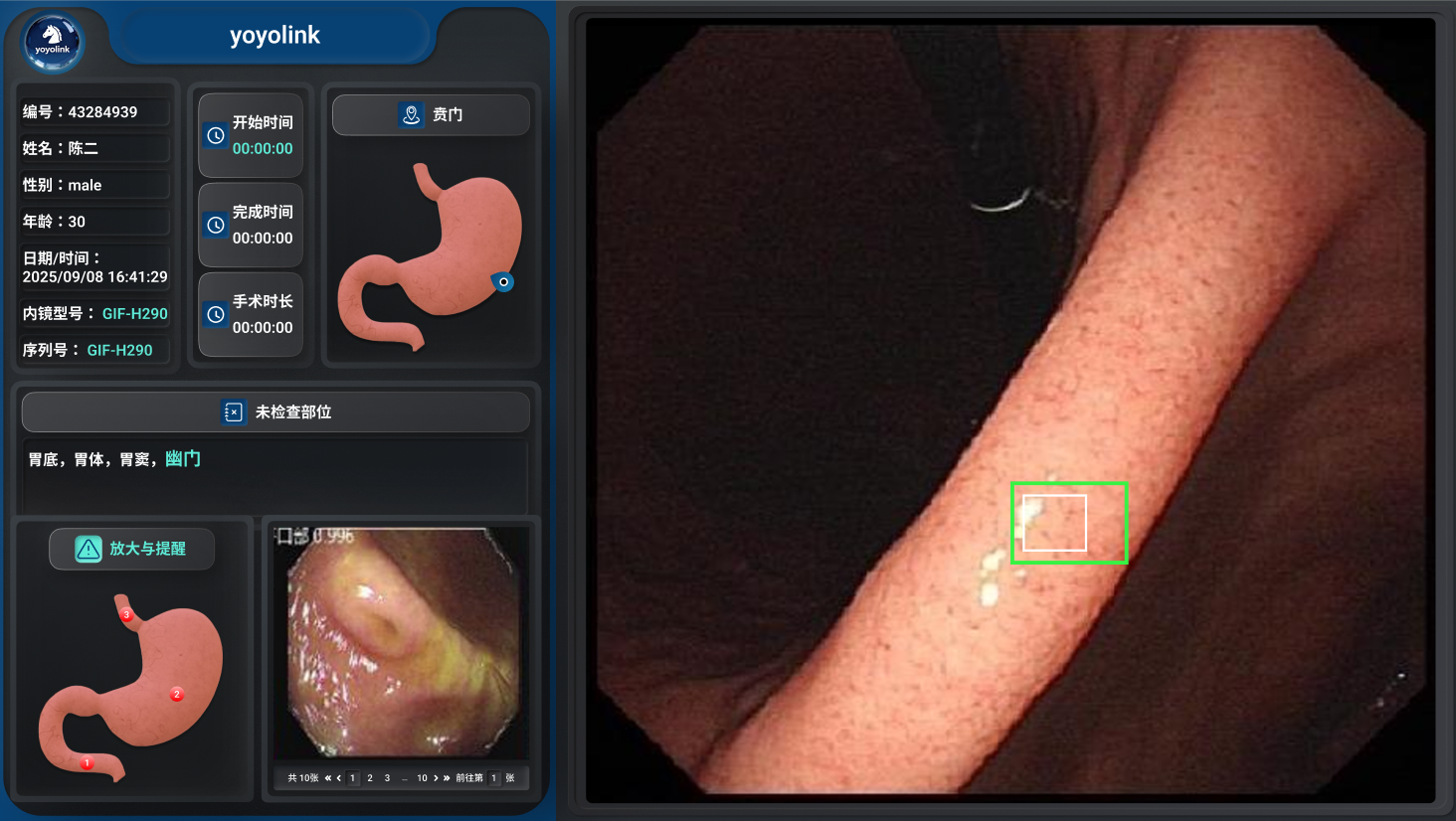 yoyolink AI GI Endoscopy System — AI-assisted gastroscopy interface